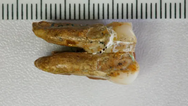 Ancient Teeth Reveal Gene Exchange Between Early Human Relatives