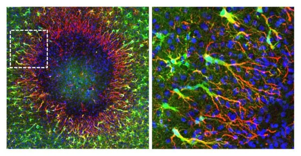 Brain Regeneration: New Study Reveals Astrocytes Repair Damage Via Nuclear Migration