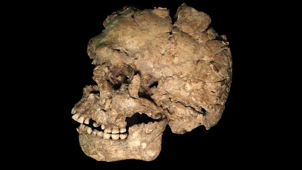 Early Human Stab Wound: Earliest Evidence of Face Trauma Found
